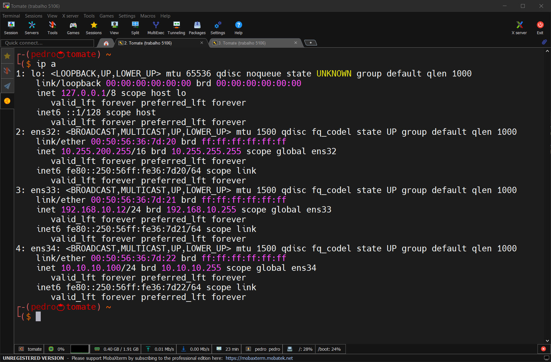 IPs das Interfaces de Rede